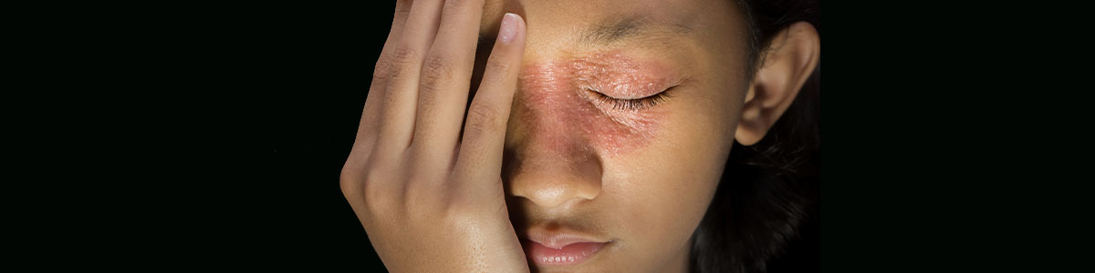 Neurodermitis - Neurodermitis Schluss mit dem Jucken!